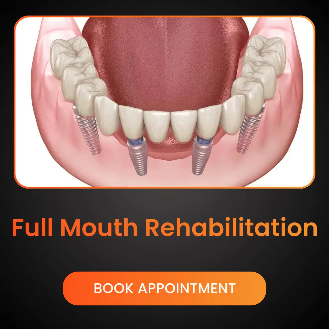Full Mouth Rehabilitation
