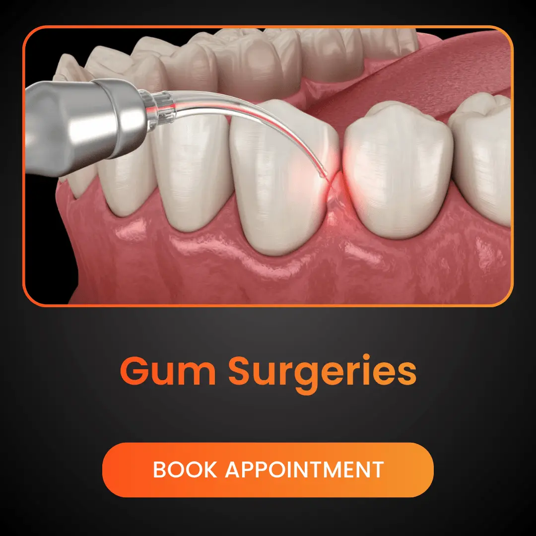 Gum Surgeries