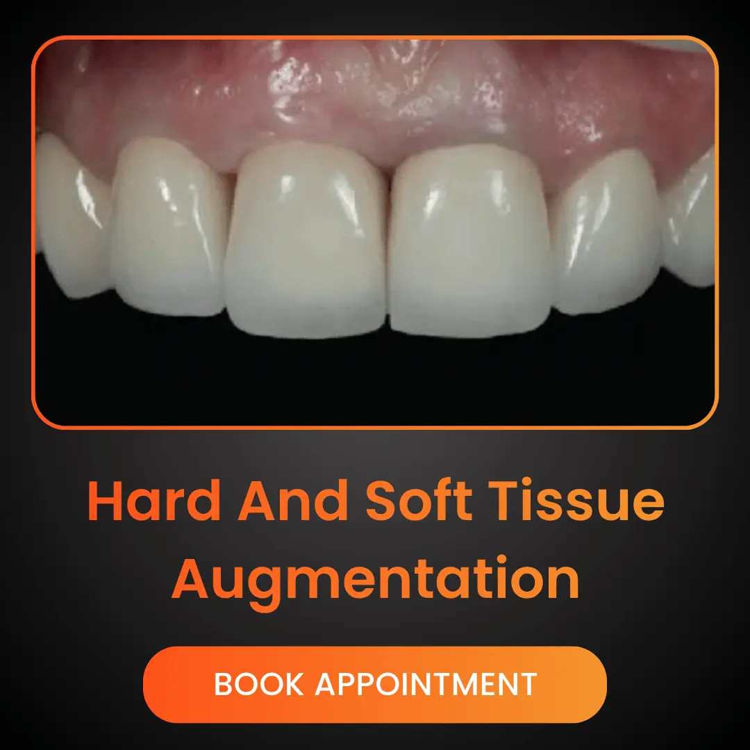 Hard And Soft Tissue Augmentation