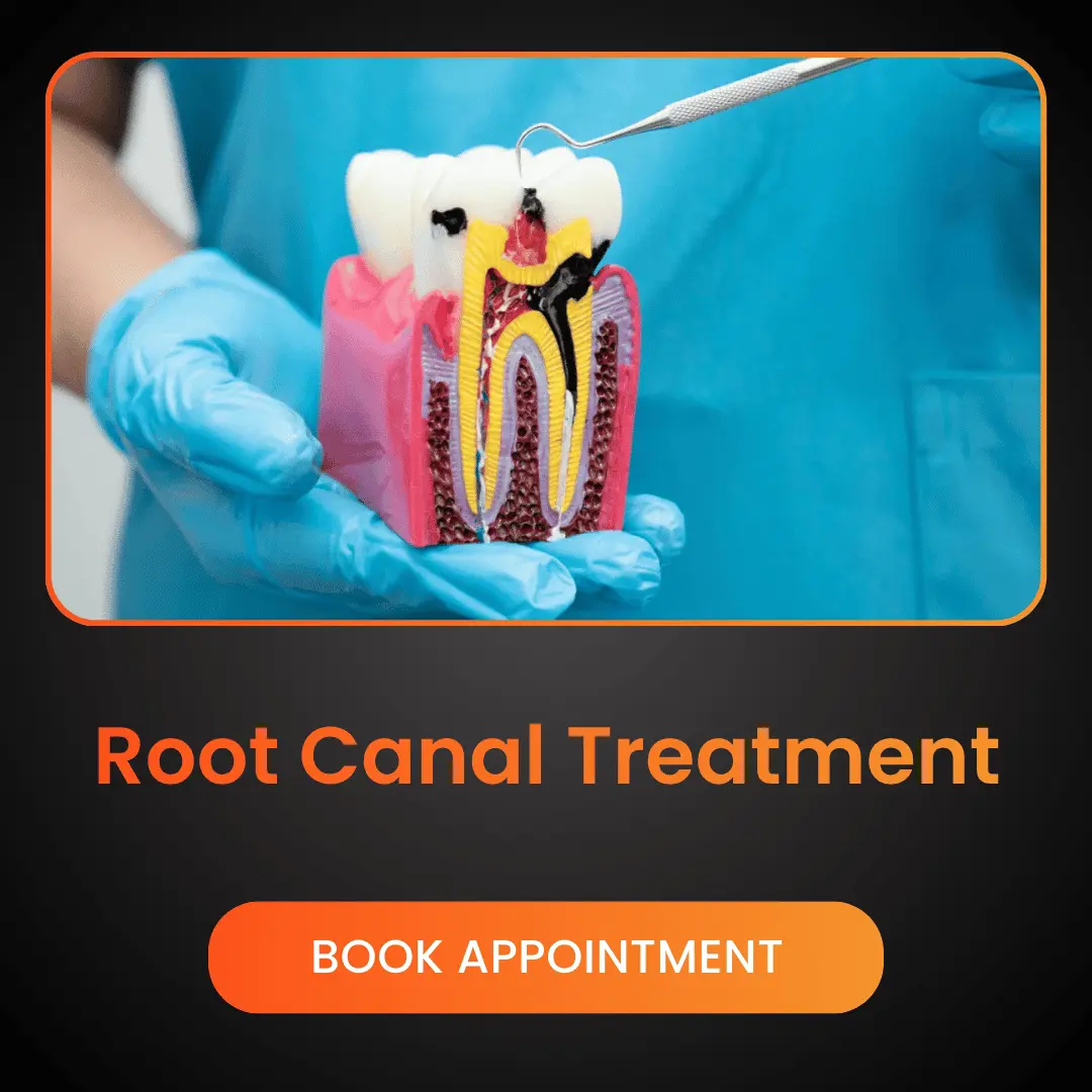 Root Canal Treatment (1)