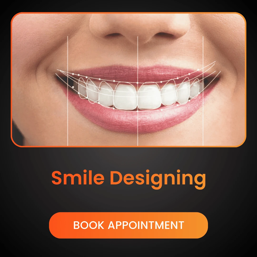 Smile Designing