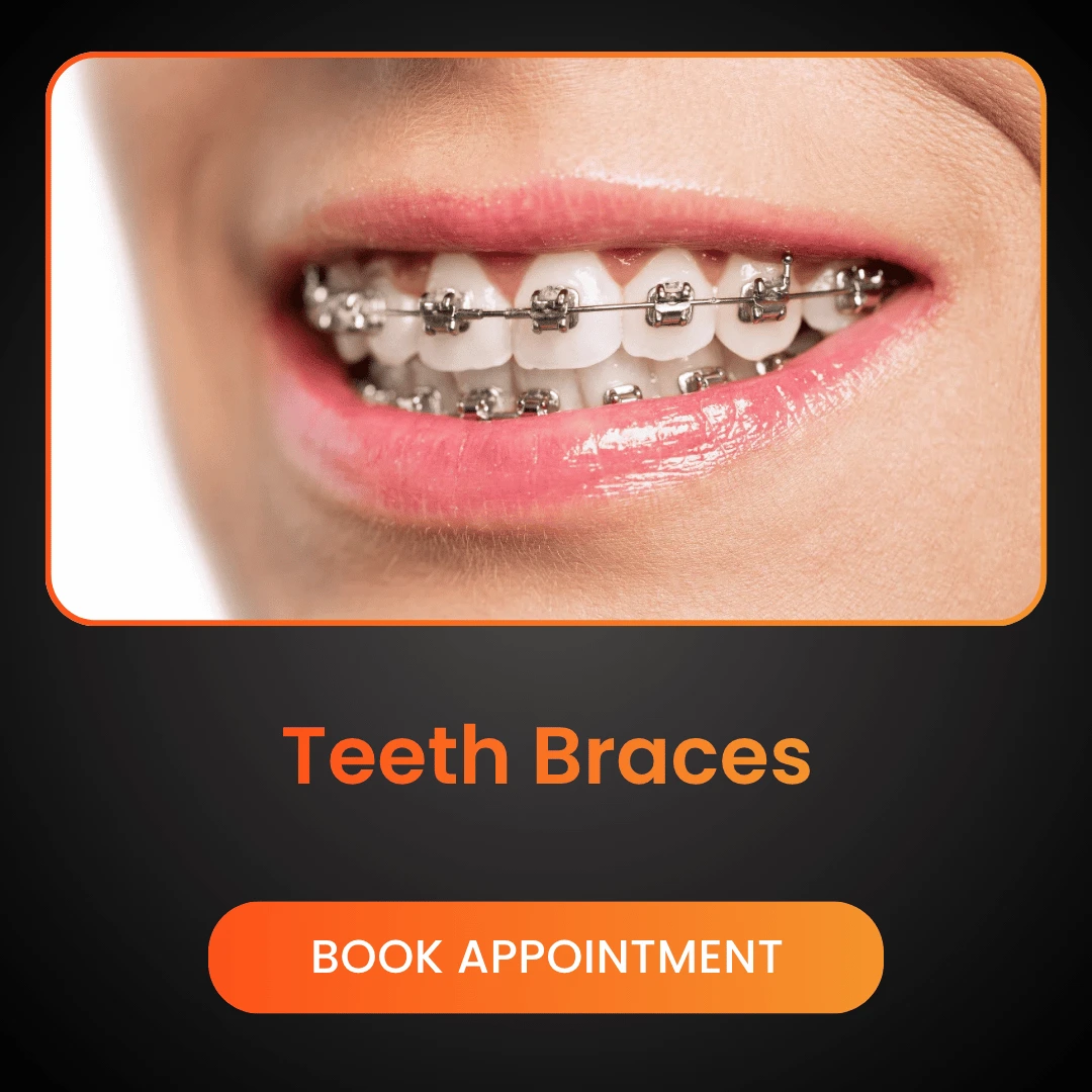 Teeth Braces