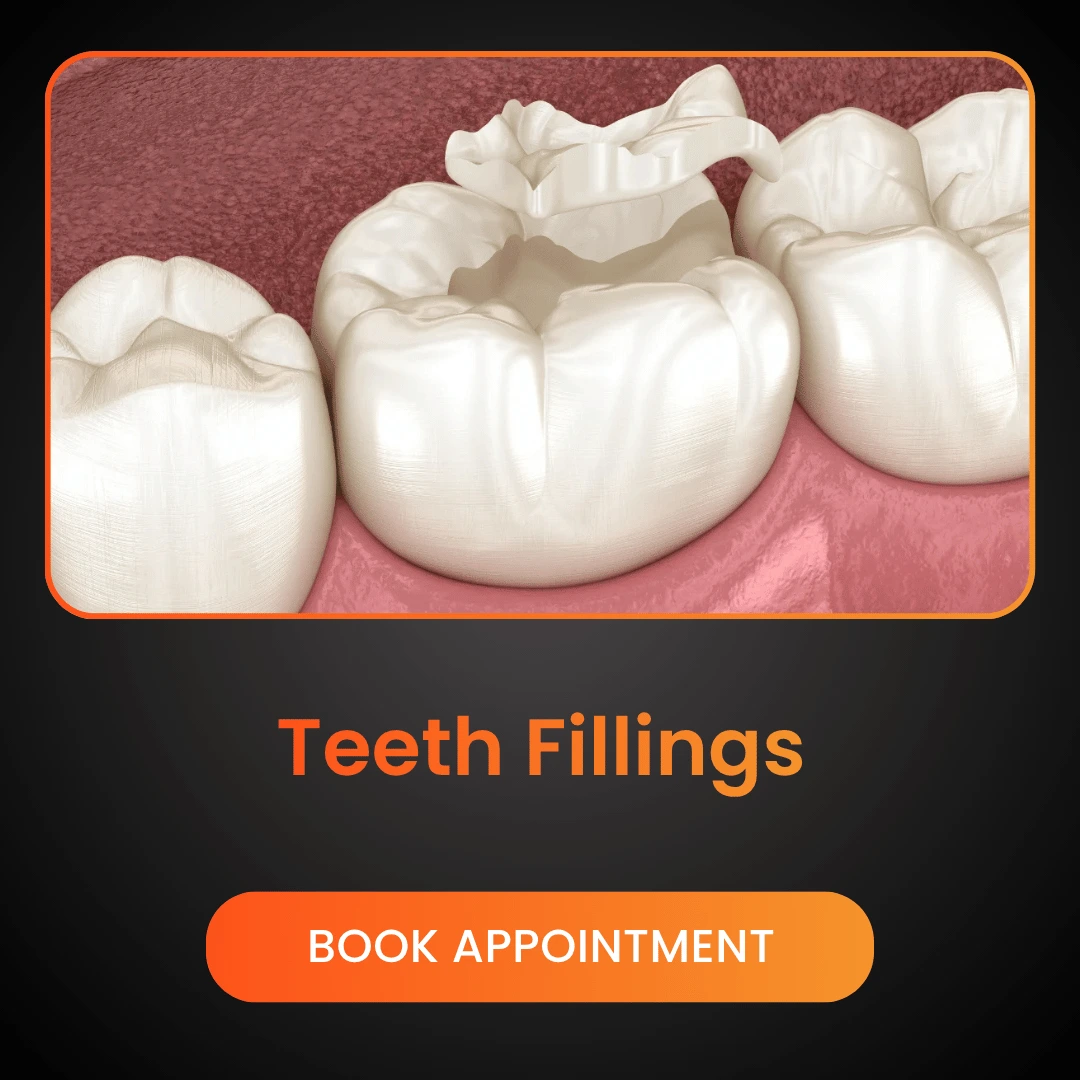 Teeth Fillings