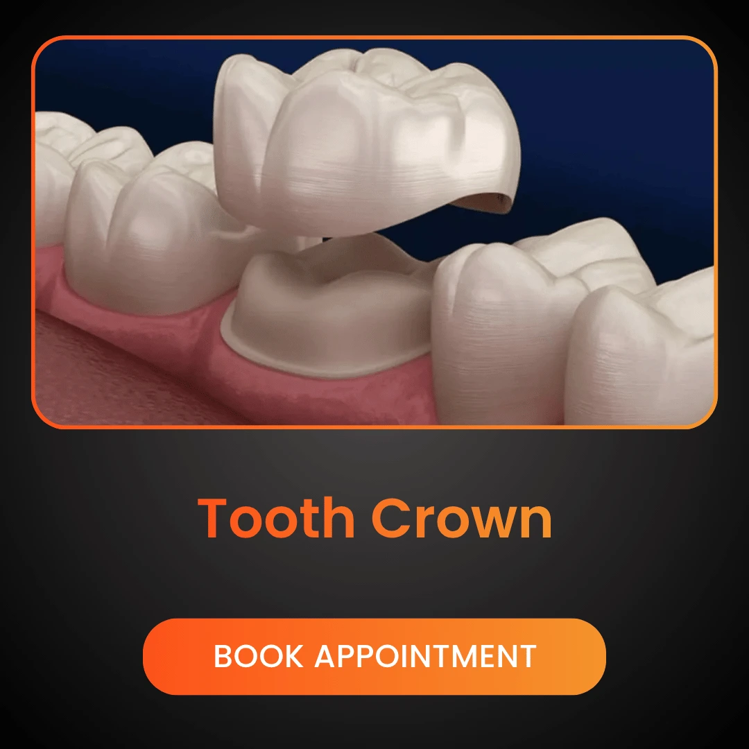 Tooth Crown